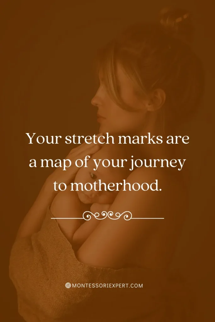 Stretch Marks Quote